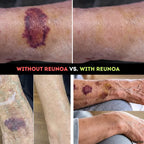 Reunoa